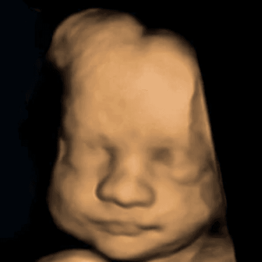 Original 3D ultrasound scan image