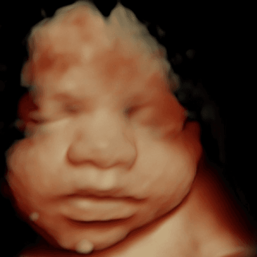 Original 3D ultrasound scan image