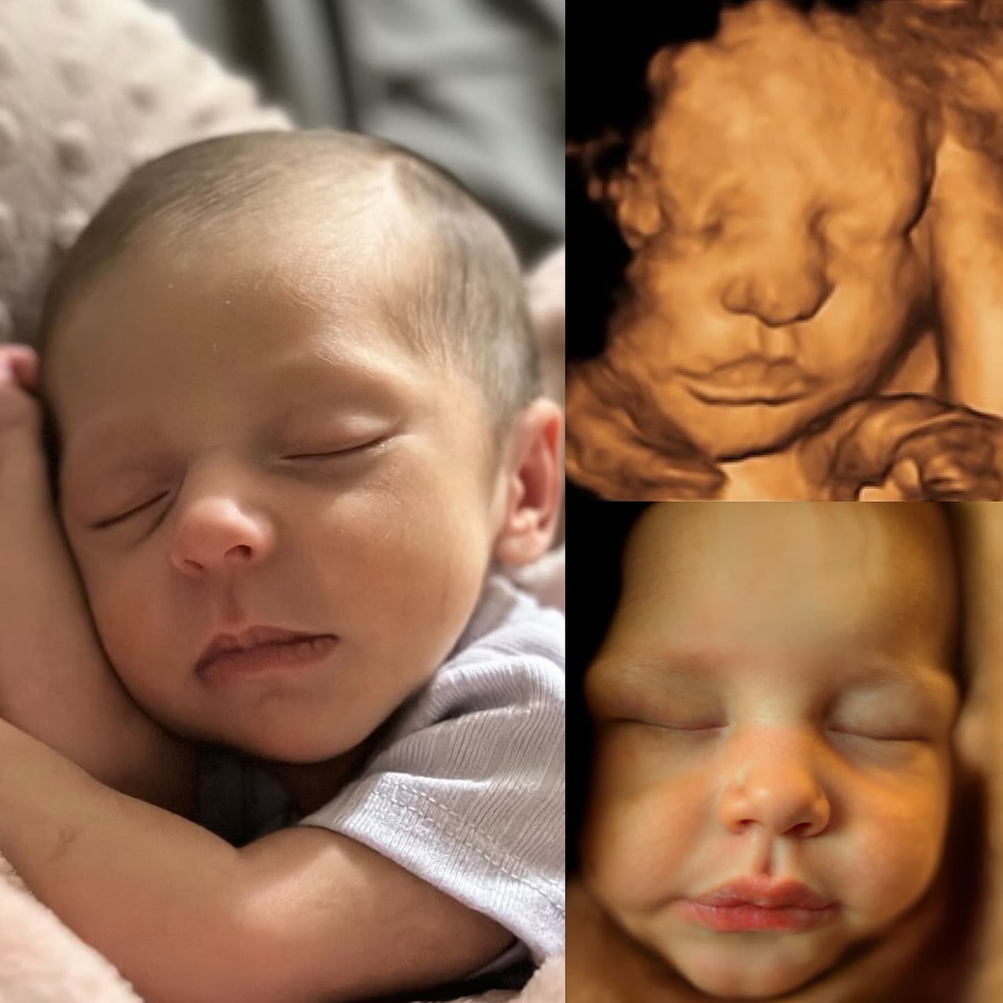 Born baby on the left, 3D ultrasound top-right, 8K AI-enhanced portrait bottom-right showing close resemblance